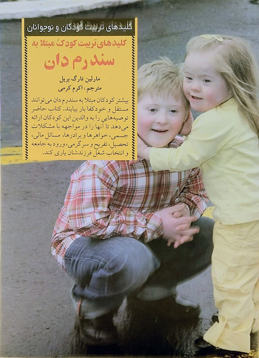 کلیدهای تربیت کودک مبتلا به سندرم دان